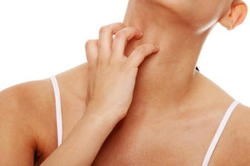 PSORIASI O DERMATITE?