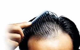 PERCHE’ CADONO I CAPELLI